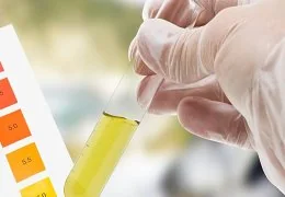Test antidroga urine THC e Cannabis? Scopri come affrontarlo al meglio!