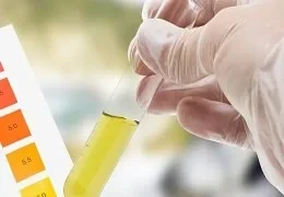 Test antidroga urine THC e Cannabis? Scopri come affrontarlo al meglio!